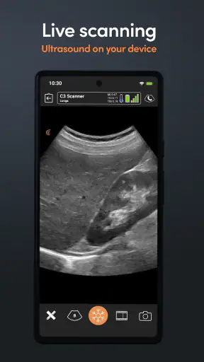 App de Ultrassom Clarius screenshot