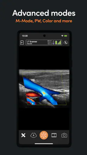 App de Ultrassom Clarius screenshot