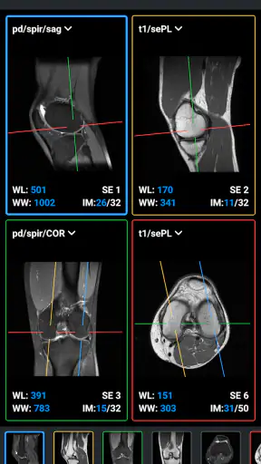 IDV - IMAIOS DICOM Viewer screenshot