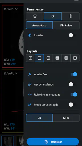 IDV - IMAIOS DICOM Viewer screenshot