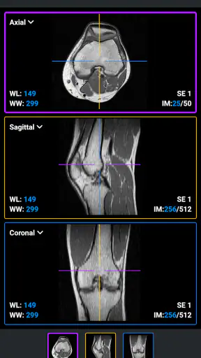 IDV - IMAIOS DICOM Viewer screenshot